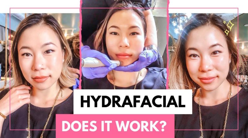 HYDRAFACIAL Review | Before and After