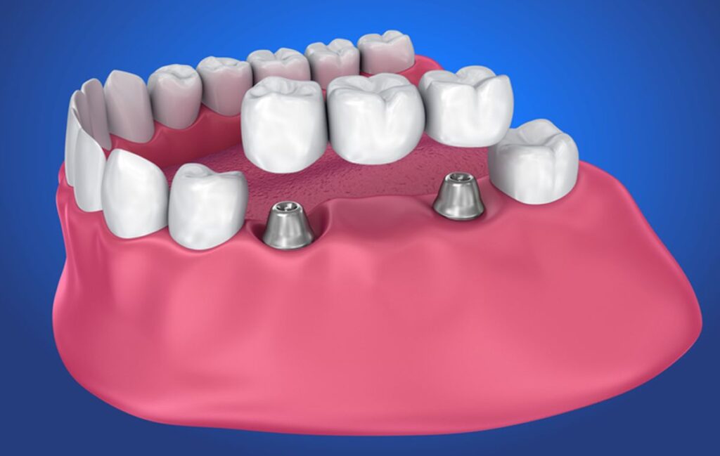NW Calgary dentist