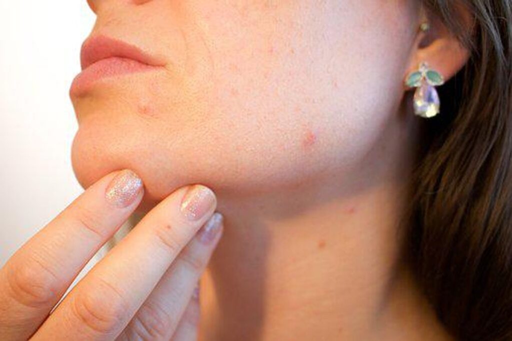 What Is Retinol